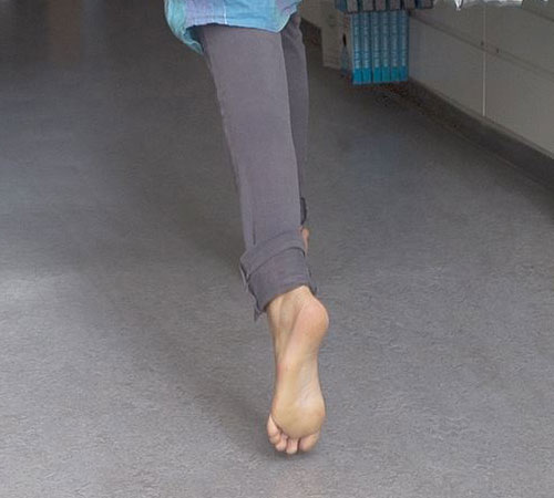 fod-fejlstillinger-born-fodklinik-aabenraa