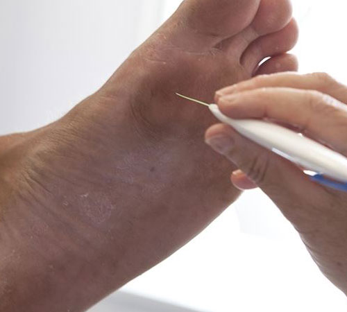 fodklinik-aabenraa-fodstatus-diabetikere