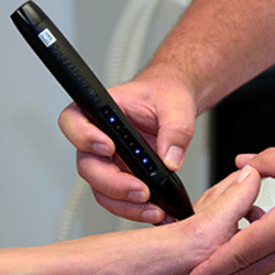 laser-abbenrå-fodterapi