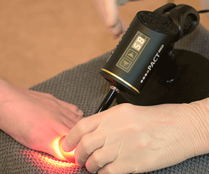 laserbehandling-aabenaa-fodklinik